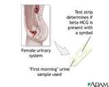 Pictures of Medical Assistant Test Washington Pictures of Medical Assistant Test Washington